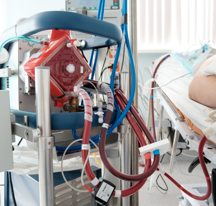 working ecmo machine in intensive care department